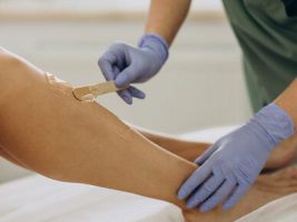 laser-epilation-hair-removal-the